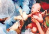 Undiagnosed disease / Measles responsible for death of nine children: DGHS