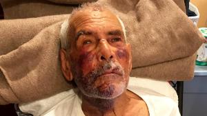 91-year-old man beaten with brick, told 'go back to Mexico'